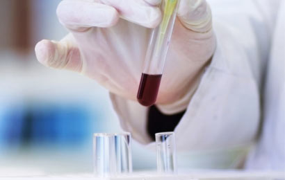 Disolventes para Análisis Clínicos